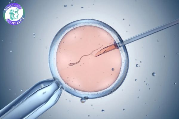 Phương pháp IVF là gì? Quy trình thực hiện phương pháp IVF ra sao?