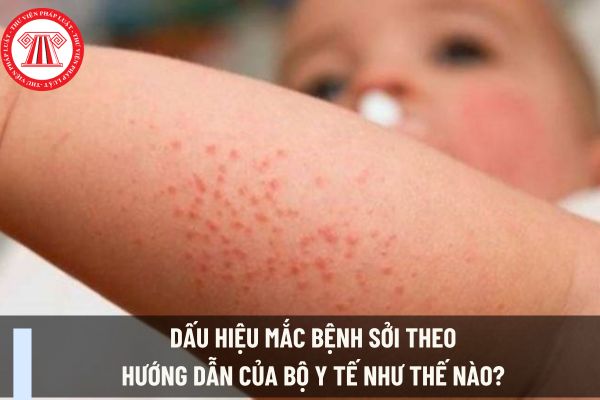 Dấu hiệu mắc bệnh sởi theo hướng dẫn của Bộ Y tế như thế nào? Người lao động có được hưởng chế độ ốm đau khi bị bệnh Sởi không?